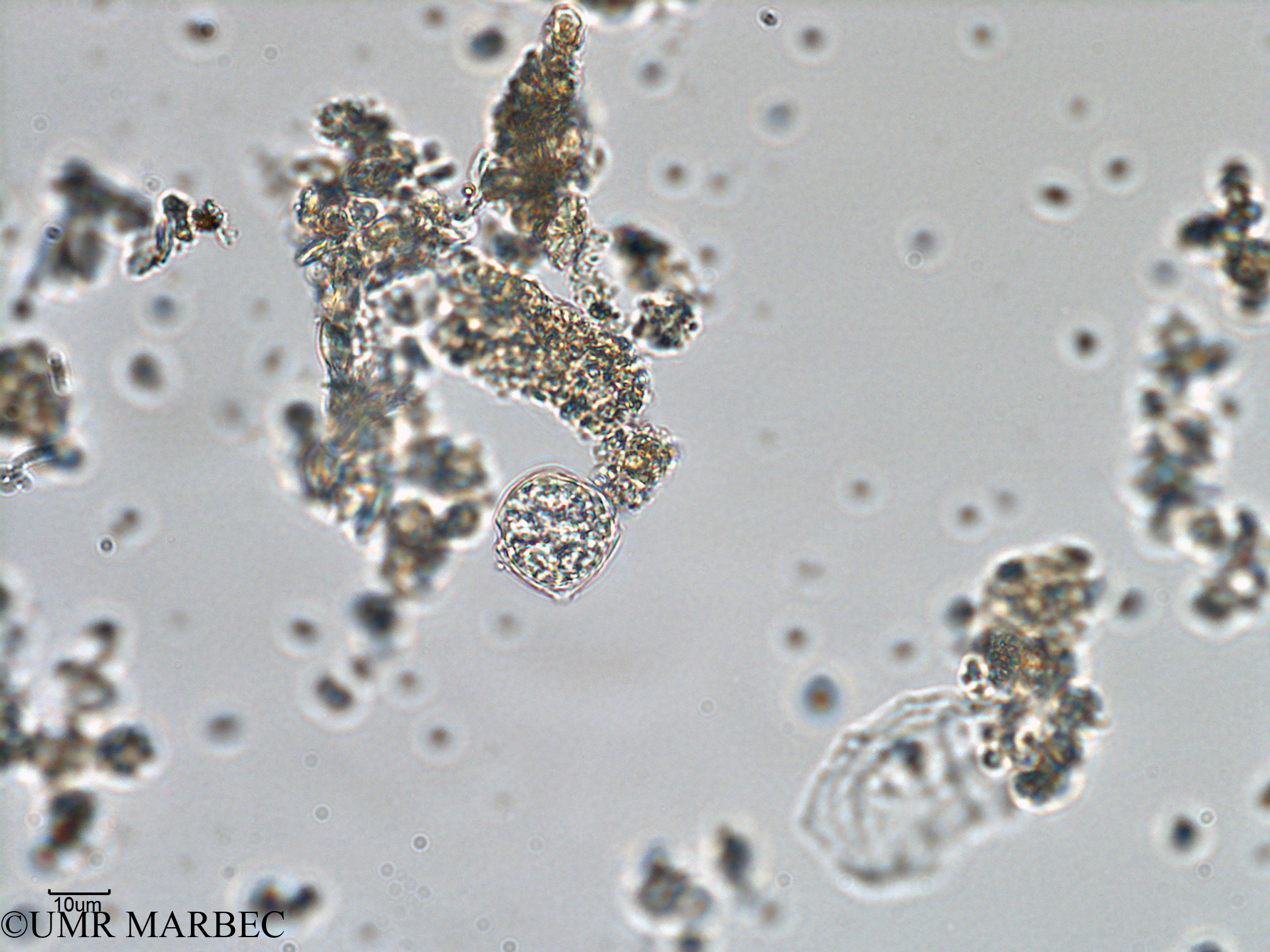 phyto/Bizerte/bizerte_bay/RISCO February 2015/Scrippsiella trochoidea (old Scrippsiella spp -ancien Baie_T1-A_Dino6-4).tif(copy).jpg